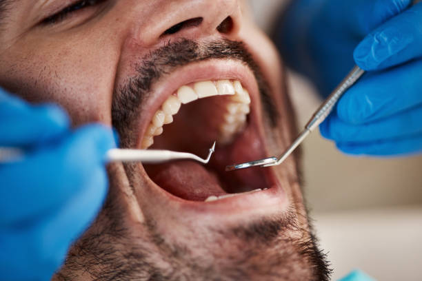 Best Broken or Cracked Tooth Emergency Dentist in Kingsland, GA